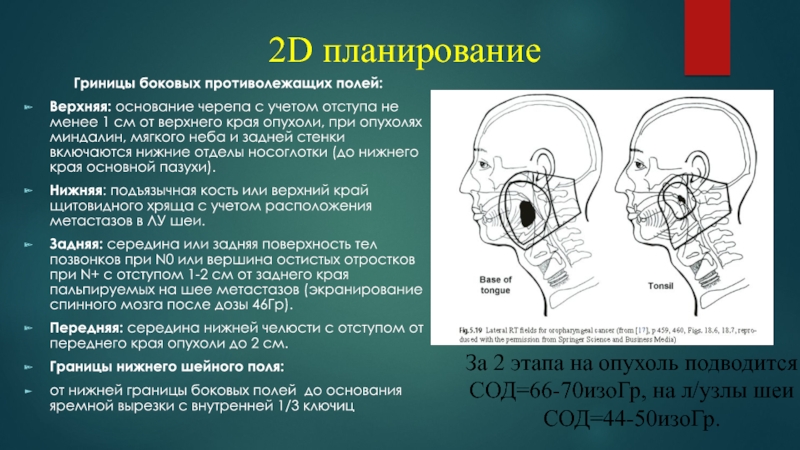 План лучевой терапии