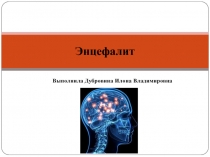 Энцефалит