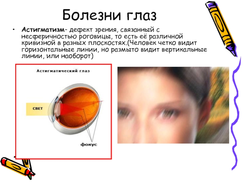 Астигматизм картинки как видно