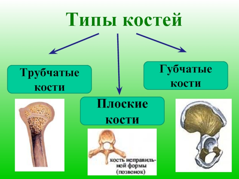 Схема виды костей