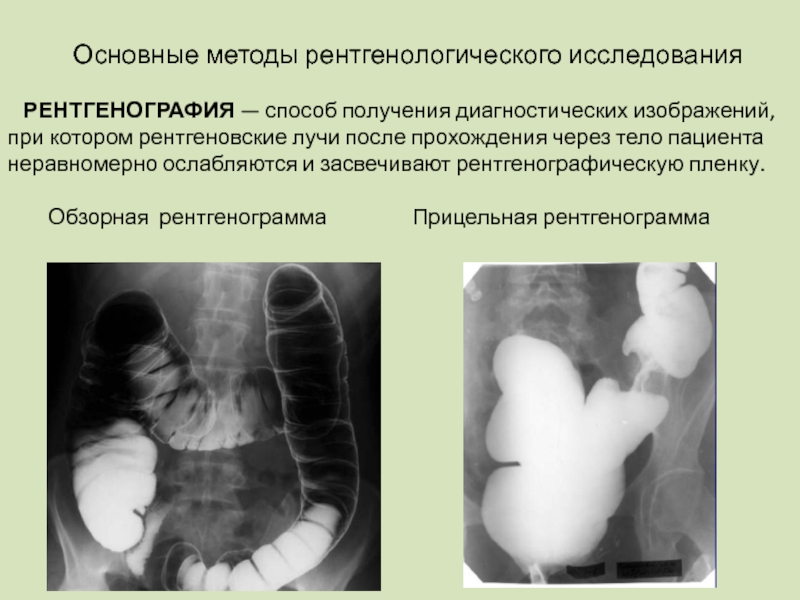 Методика получения рентгеновского изображения