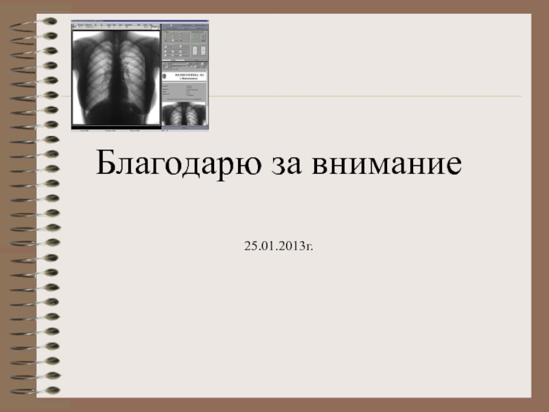 Флюорография картинки для презентации