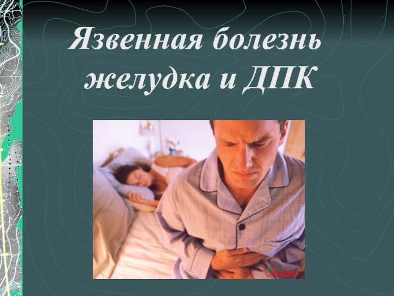 Презентация Язвенная болезнь желудка и ДПК