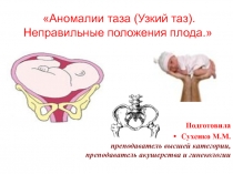Аномалии таза (Узкий таз).
Неправильные положения плода.
Подготовила
Сухенко
