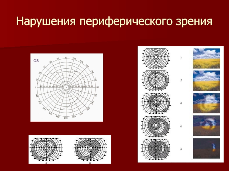 Периферическое зрение. Нарушение периферического зрения. Функции периферического зрения. Тест на периферическое зрение. Периферийное зрение как развить.