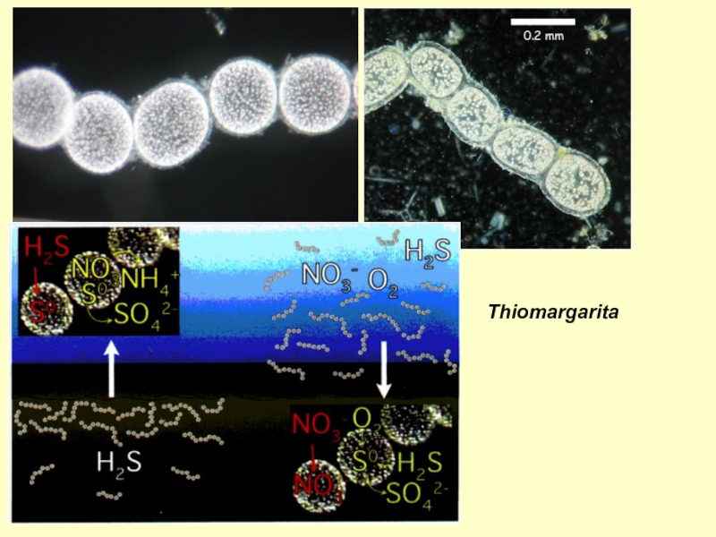 Thiomargarita namibiensis фото