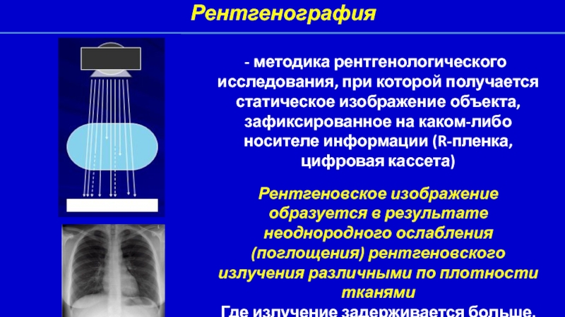 Получения рентгеновского изображения