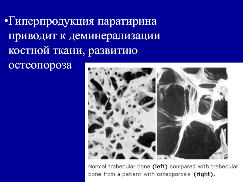 Регуляция костной ткани. Минерализация костной ткани. Процесс минерализации костной ткани. Деминерализация костей. Локальная порозность костной ткани.