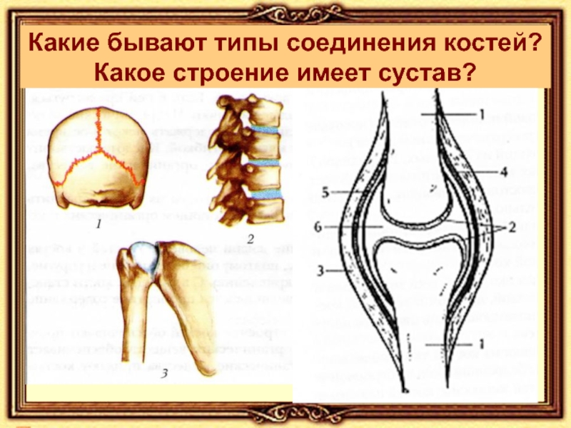 Тип соединение бедренной кости. Какие типы соединения костей бывают. Опорно двигательная система типы соединений костей.