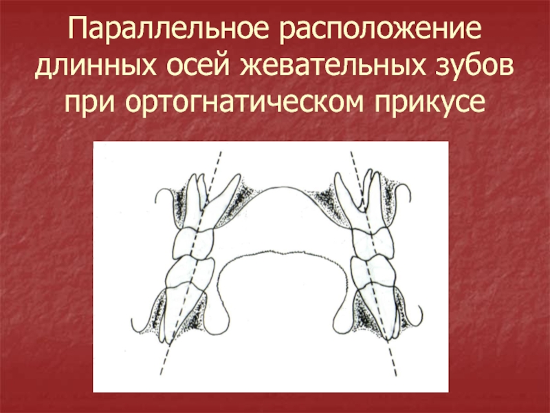 Параллельное расположение. Длинная ось зуба. Параллельное расположение зубов. Зубы располагаются параллельными рядами.