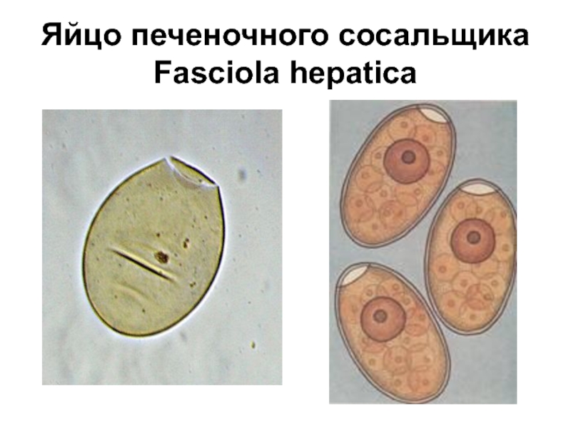 Яйца кошачьего сосальщика рисунок