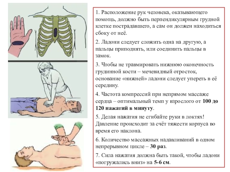 Давление руками на грудину. Давление руками на грудину пострадавшего. Давления руками на грудину пострадавшег. +Нажатия руками на грудную клетку пострадавшего. Как следует расположить руки на грудной клетке пострадавшего.