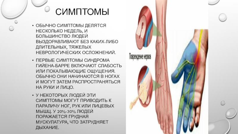 Синдром миллера дикера фото