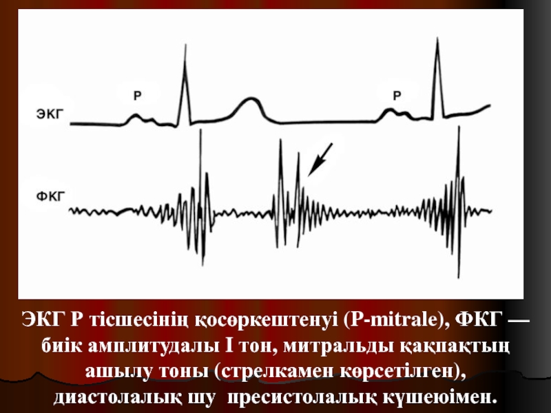 Экг и фкг