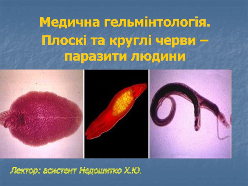 Медична гельмінтологія.
Плоскі та круглі черви – паразити людини
Лектор: