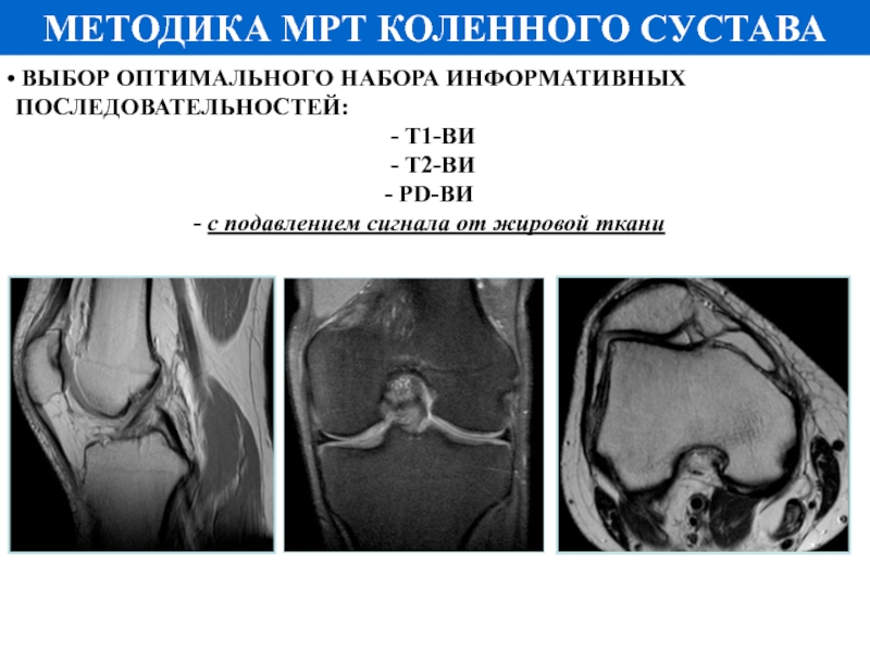 Т1 т2 взвешенное изображение