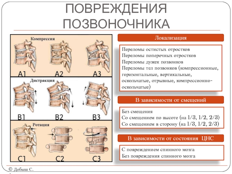 Перелом позвоночника тесты с ответами