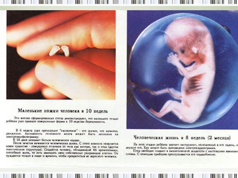 Всё о абортах…