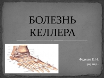 болезнь келлера