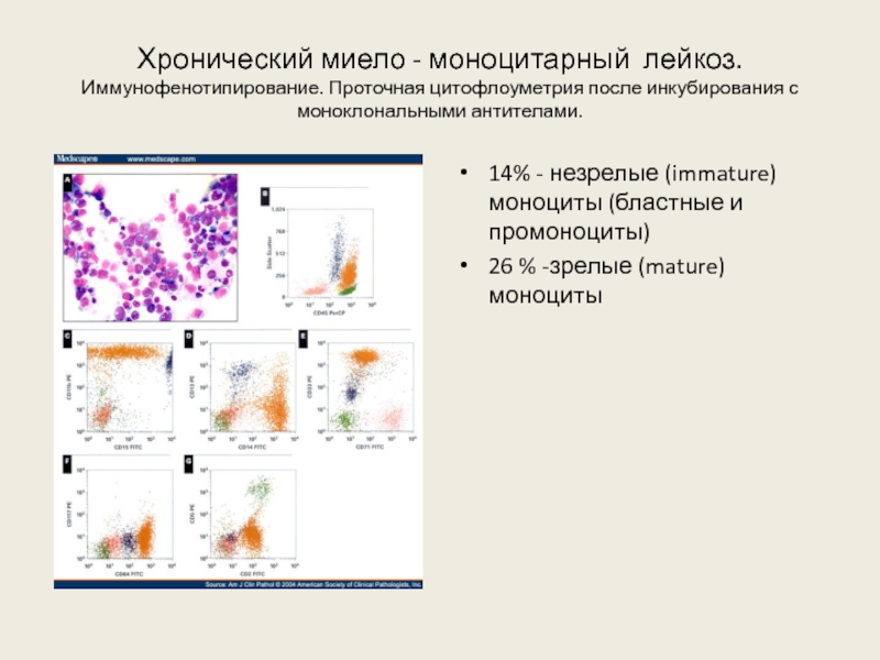 При хроническом моноцитарном лейкозе в картине крови характерен