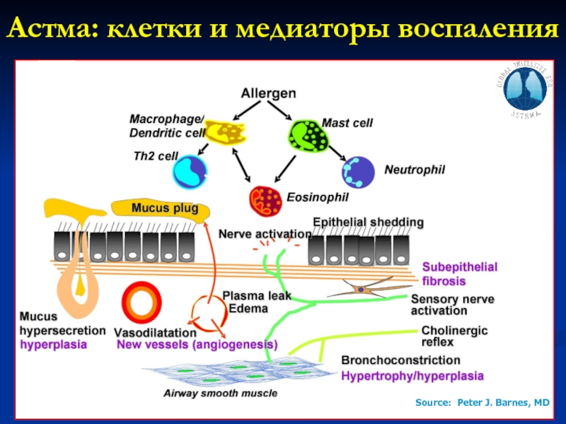 Клетки воспаления. Бронхиальная астма медиаторы воспаления. Бронхиальная астма клетки воспаления. Клеточные медиаторы воспаления схема. Медиаторы при бронхиальной астме.