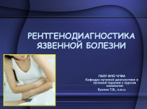 РЕНТГЕНОДИАГНОСТИКА ЯЗВЕННОЙ БОЛЕЗНИ