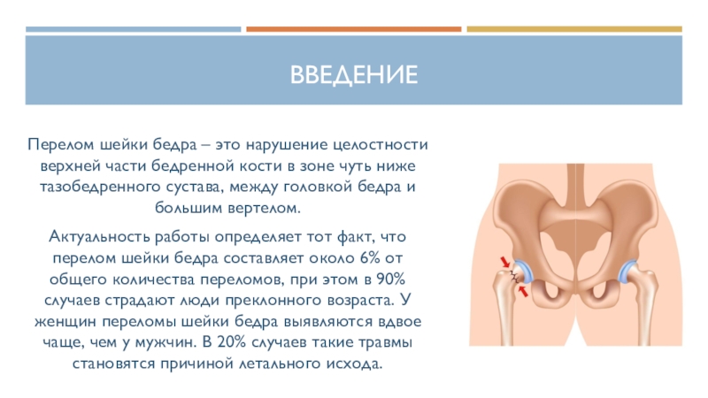 План ухода за пациентом при переломе шейки бедра