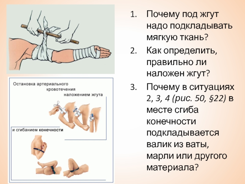 Почему жгут. Зачем накладывают жгут. Почему под жгут надо подкладывать мягкую ткань. Как определить правильно ли наложен жгут. Наложения жгута ткань под жгут.