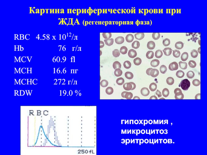 Картина крови при анемии