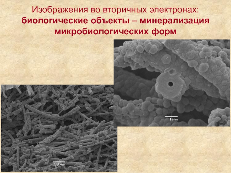 Изображения во вторичных электронах: биологические объекты – минерализация микробиологических форм