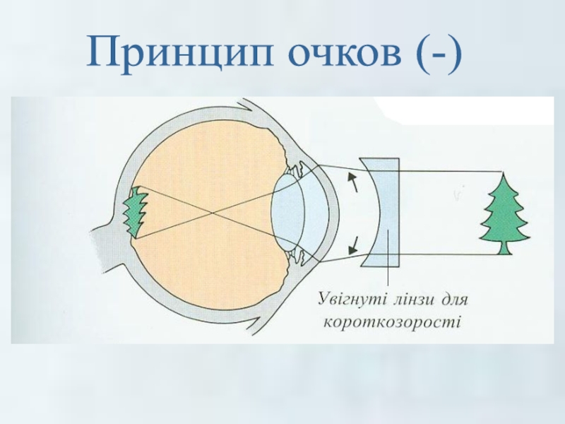 Презентация глаз очки