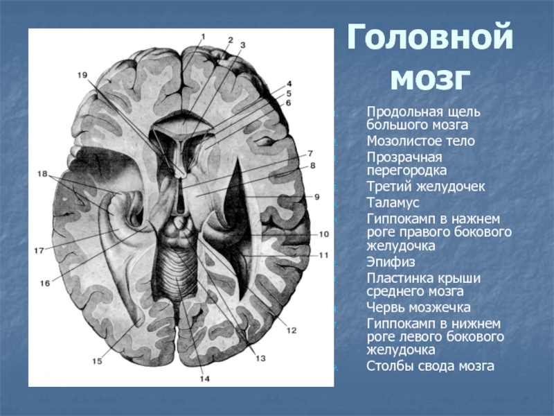 Прозрачная перегородка мозга. Поперечная щель головного мозга. Столбы свода головного мозга. Прозрачная перегородка анатомия. Прозрачная перегородка головного мозга.