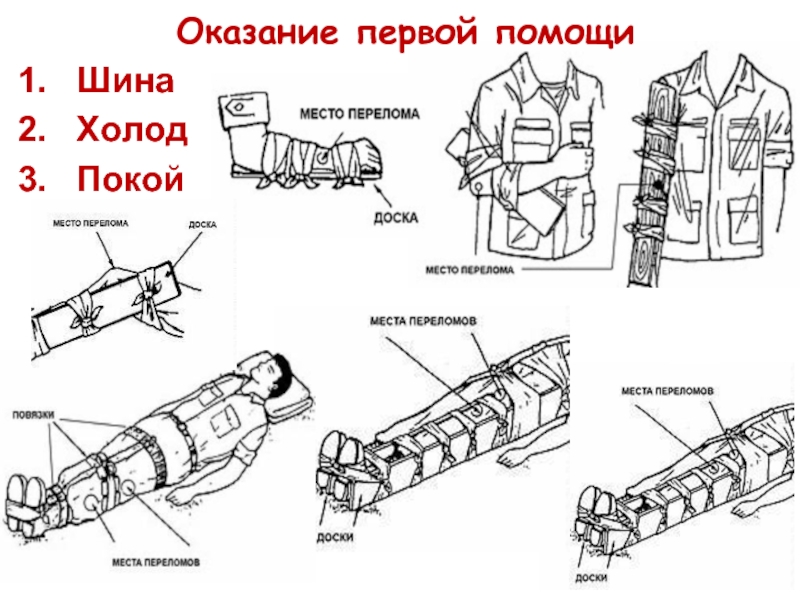 План конспект первая помощь при переломах и вывихах