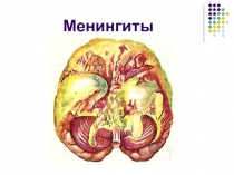 Менингиты