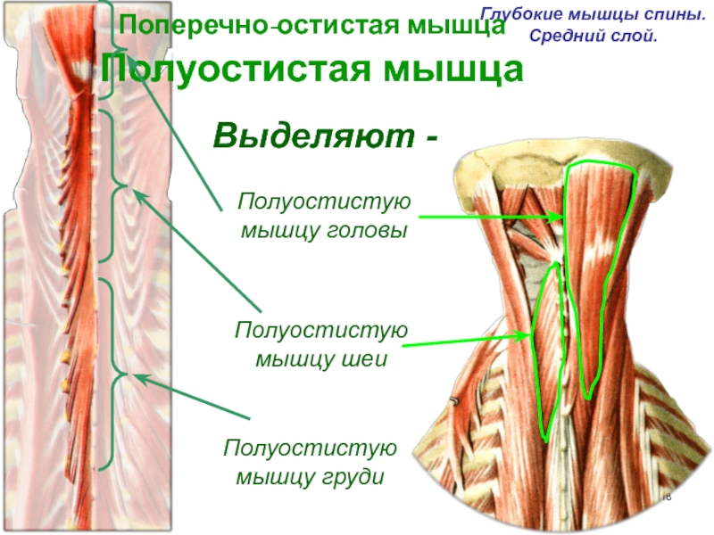Слои мышц. Мышцы спины поперечно-остистая мышца. Глубокий слой мышц. Полуостистая мышца. Мышцы спины глубокий слой.