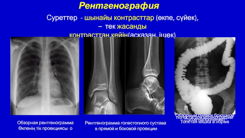 Почему на рентгеновском снимке изображение костей получается белым