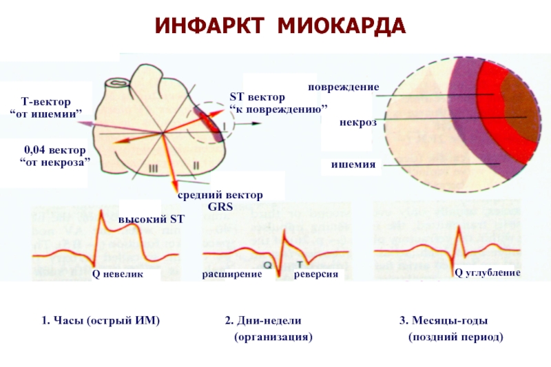 Коронарная недостаточность патофизиология презентация