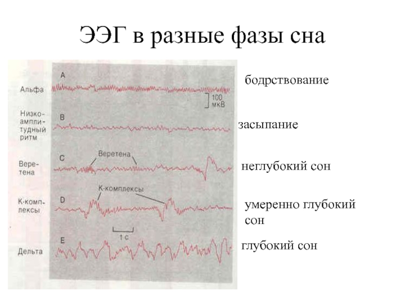 Схема стадий сна по данным ээг