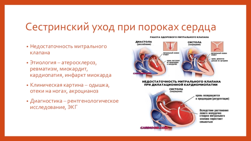 Реферат: Неревматические миокардиты