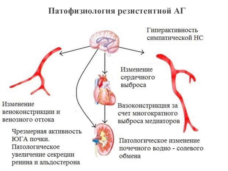 Патофизиология артериальной гипертензии презентация