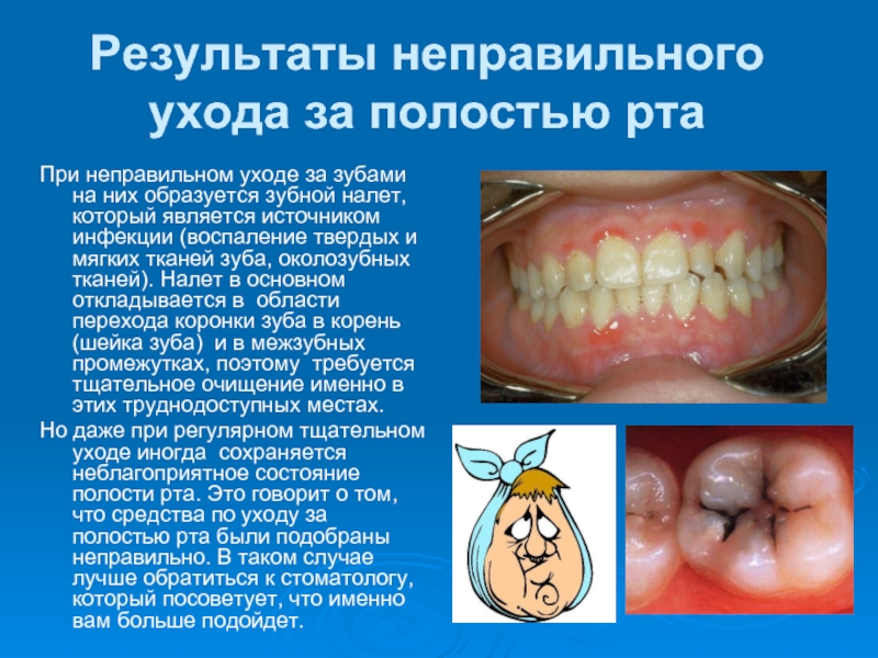 Результаты неправильного ухода за полостью рта При неправильном уходе за зубами на них образуется зубной налет, который