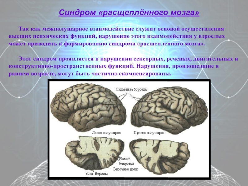 Асимметрия мозга презентация