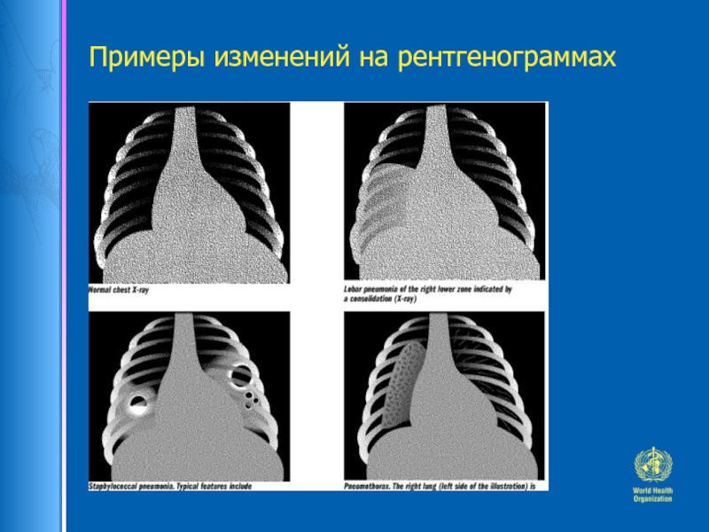 Примеры изменения. Образец изменения формы волна. Образец изменения графия.