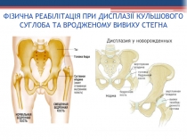 ФІЗИЧНА РЕАБІЛІТАЦІЯ ПРИ ДИСПЛАЗІЇ КУЛЬШОВОГО СУГЛОБА ТА ВРОДЖЕНОМУ ВИВИХУ