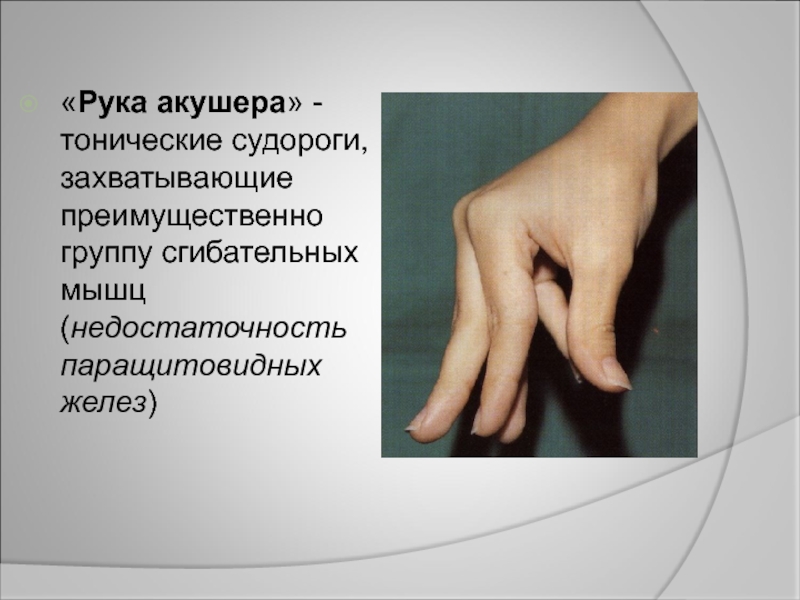 Сводит судорогой пальцы рук причина. Синдром акушерской руки.