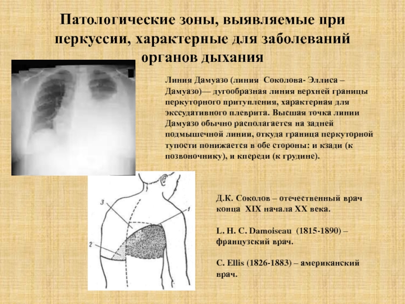 Обследование дыхательной системы у детей презентация