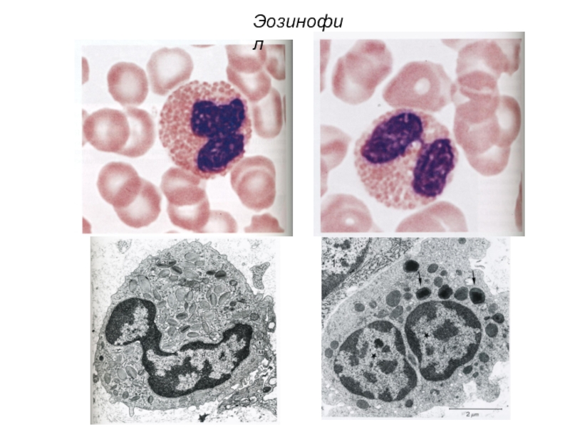 Эозинофилы это. Эозинофилы морфология клетки. Эозинофил микрофотография. Эозинофилы функции гистология. Эозинофилы строение гистология.