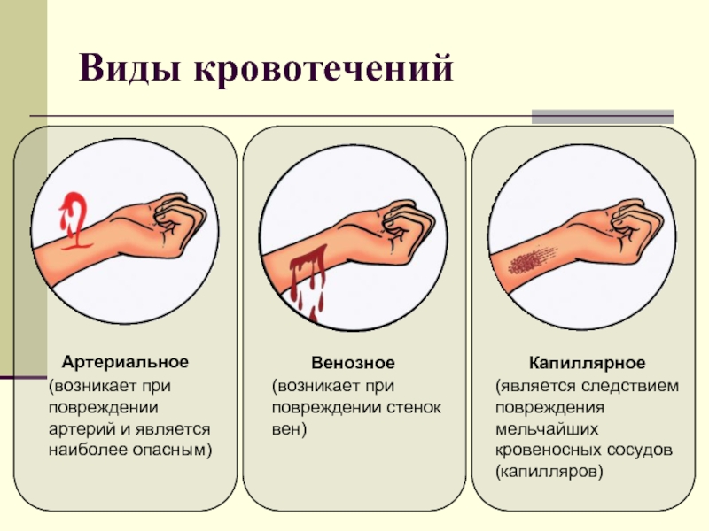 Кровотечение на фоне приема джес