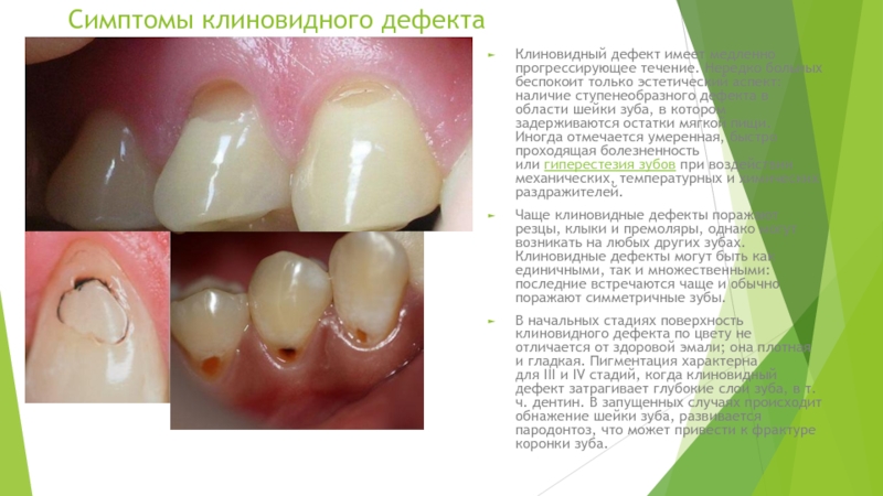 Скачать Реферат На Тему Пародонтоз История Возникновения