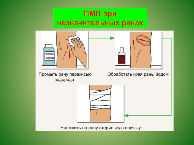 Первая помощь при наружных кровотечениях обж